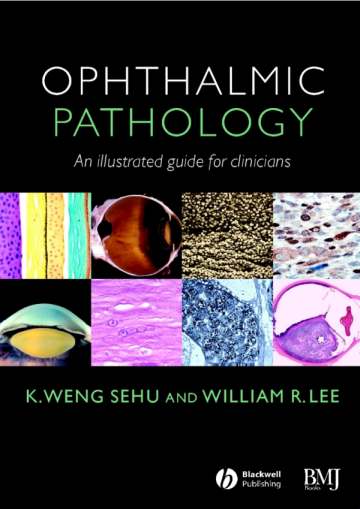 A TEXTBOOK OF CLINICAL OPHTHALMOLOGY 3rd edition Crick & Khaw